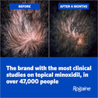 Men's Rogaine 5% Minoxidil Foam for hair loss and hair regrowth in Pakistan