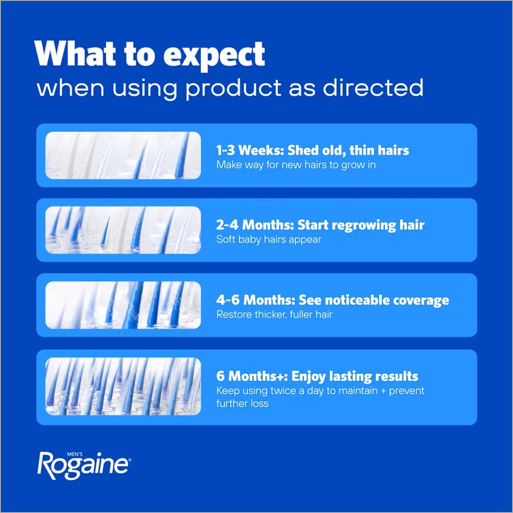 Men's Rogaine 5% Minoxidil Foam for hair loss and hair regrowth in Pakistan
